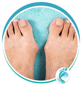 Bunions Treatment in Lyndhurst, OH