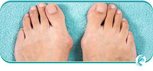 Bunion Specialist Questions and Answers Bunion Specialist Questions and Answers