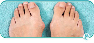 Bunion Specialist Questions and Answers