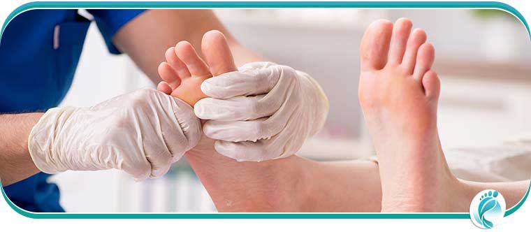 Gout Treatment in Lyndhurst, OH Gout Treatment in Lyndhurst, OH
