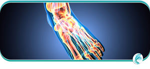 Poor Circulation Treatment in Lyndhurst, OH Poor Circulation Treatment in Lyndhurst, OH