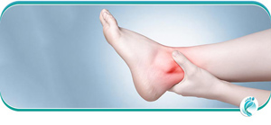 Sprained Ankle Treatment Specialist Near Me in Lyndhurst, OH