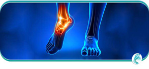 Foot Arthritis Specialist Near Me in Lyndhurst, OH