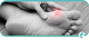 Calluses and Corns Treatment Specialist in Lyndhurst, OH